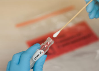 Avviso per manifestazione di interesse nell’ambito delle attività di Federlab Italia nel contrasto dell’epidemia da Sars-CoV2 (Scadenza 14.12.2020)