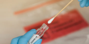 Avviso per manifestazione di interesse nell’ambito delle attività di Federlab Italia nel contrasto dell’epidemia da Sars-CoV2 (Scadenza 14.12.2020)