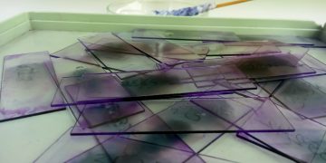 Morfologia ematologica su striscio di sangue venoso periferico e rischio clinico